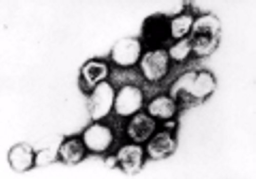 rubella virus